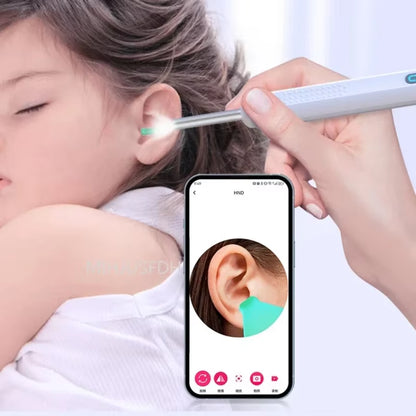 Visual Ear Cleaner with Camera LED Lights Lens Ear Wax Removal Tool Take Video HD Ear Wax Removal Tool Dropshipping